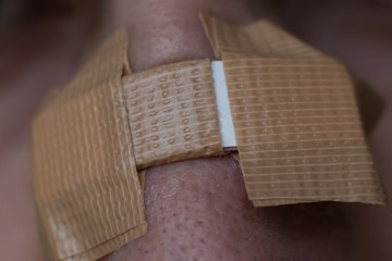 handmade nasal strip