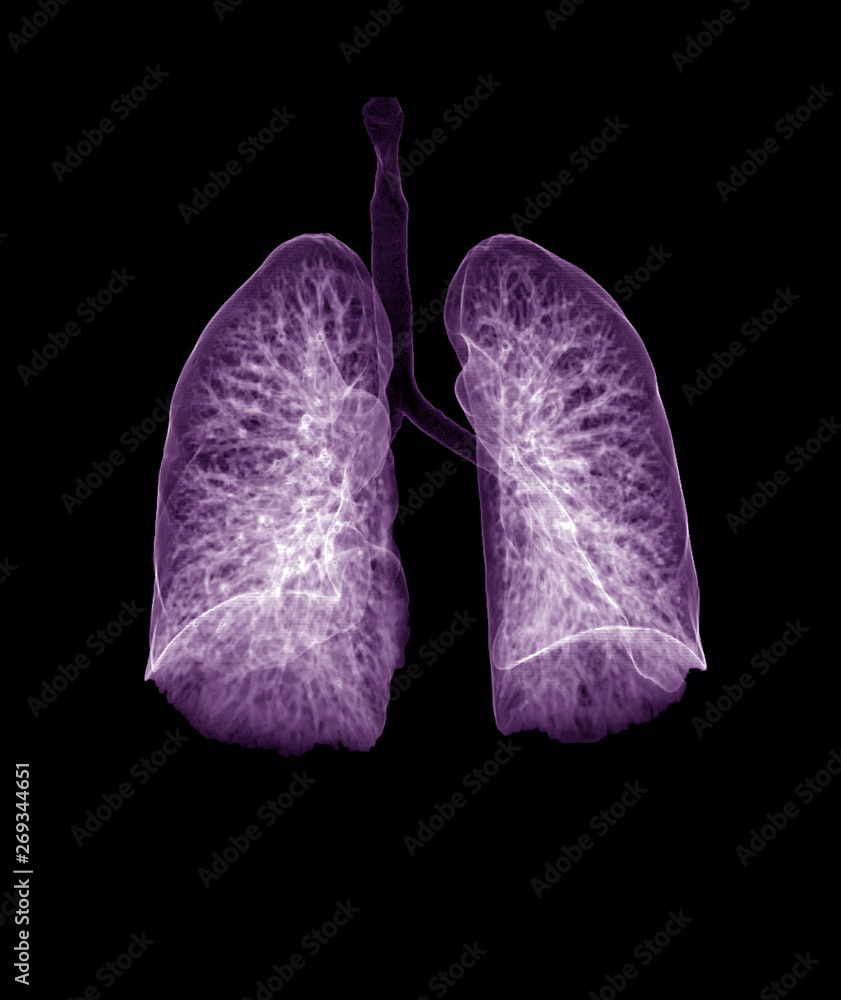 Poster ct chest or ct lung 3d rendering image with purple color showing trachea and lung in respiratory sys