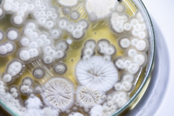 Fototapeta na wymiar Mold Beautiful, Colony of Characteristics of Fungus (Mold) in culture medium plate from laboratory microbiology.