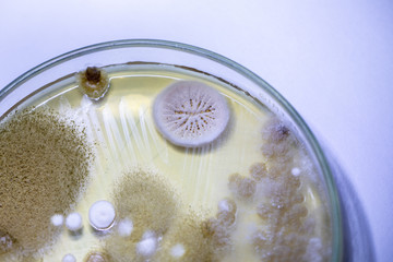 Fototapeta na wymiar Mold Beautiful, Colony of Characteristics of Fungus (Mold) in culture medium plate from laboratory microbiology.