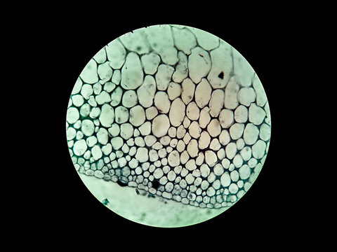 Collenchyma,which is one of the plant ground cells, under 200x magnification