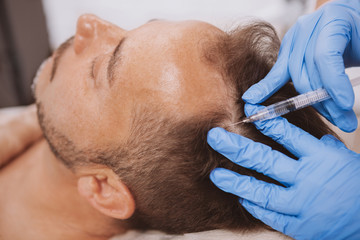 Close up of a mature man receiving hairloss treatment injections in scalp by professional...