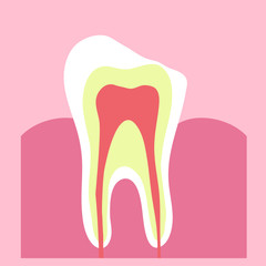 Tooth and chip on it on a pink background. Vector illustration. 