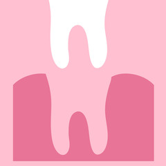 Removal of a tooth. Tooth and gum on a pink background. Dentistry Vector illustration. 