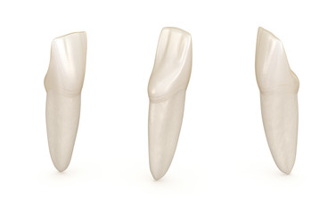 Dental anatomy - mandibular central incisor tooth. Medically accurate dental 3D illustration - obrazy, fototapety, plakaty