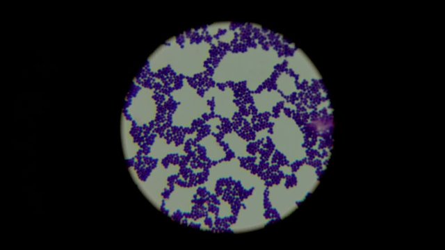 Researching of human biological sample using microscope. Biochemical identification of staphylococcus bacteria