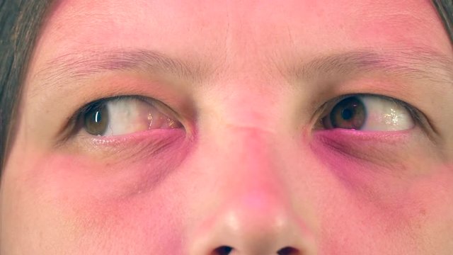 Young woman with tired eyes from long work at computer shows various exercises for eyes, approved by doctor. Gymnastics against strabismus. Remedial exercises. Ophthalmological allowance