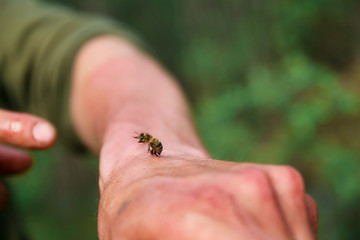 bee sting. a bee stung a man and left a sting in his hand