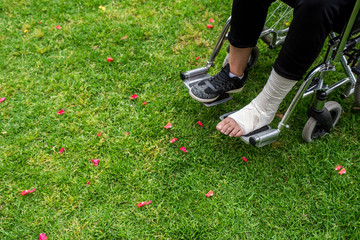 Seen from above a feet in a wheelchair. Foot with sprain on grass bottom