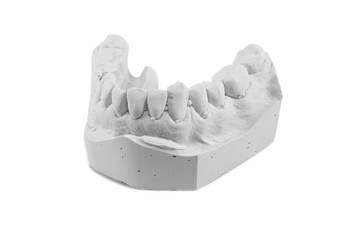 Denture gypsum model isolated on white background.