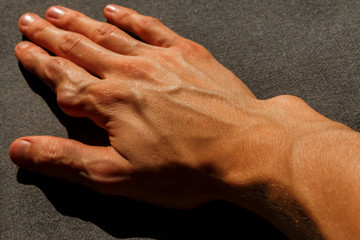 tumor on the finger caused by Ollier disease. man hand on the gray background.