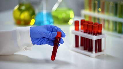 Biochemist checking blood serum reaction in test sample, health check-up - obrazy, fototapety, plakaty