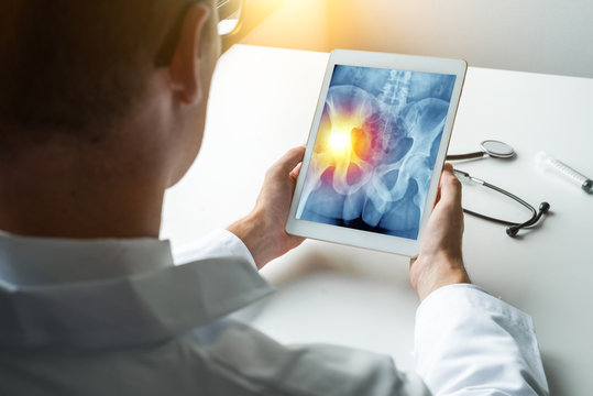 Doctor holding a digital tablet with x-ray of hips with pain in the left