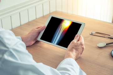 Doctor holding a digital tablet with x-ray of the leg. Pain on the internal knee