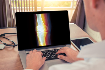 Doctor watching a laptop with x-ray of leg with pain in the bones. Radiology concept