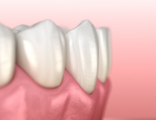 Fototapeta na wymiar Mandibular human gum and teeth anatomy. Medically accurate tooth 3D illustration