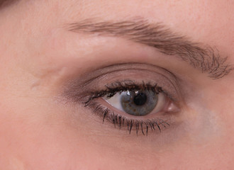 Obraz premium Large scar near the eye on the caucasian girl's face, close-up, cosmetology