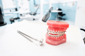 dental model with braces - Teeth orthodontic dental model with dental braces in dentist clinic -