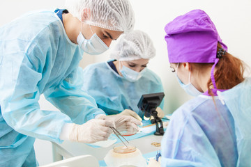 The doctor under the microscope recalculates the hair follicles. Baldness treatment. Hair transplant. Surgeons in the operating room carry out hair transplant surgery. Surgical technique that moves