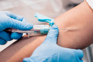 Plasma lifting - blood sampling from a vein to separate plasma in a centrifuge