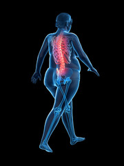 Obraz premium 3d rendered medically accurate illustration of an obese womans