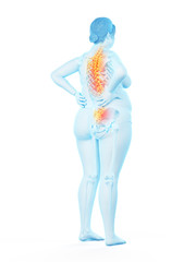 3d rendered medically accurate illustration of an obese womans