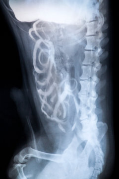male skeleton X-ray dark background