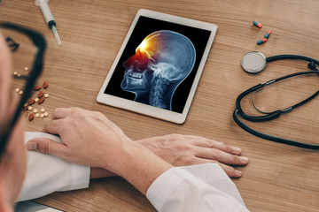 Doctor watching a digital tablet with x-ray of skull with a pain in the front of the head