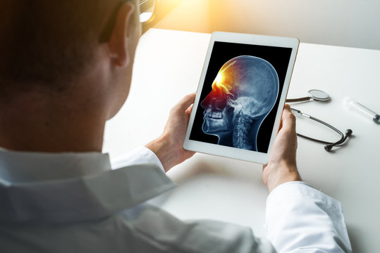 Doctor holding a digital tablet with x-ray about spine with pain on the forehead. Migraine and headache concept