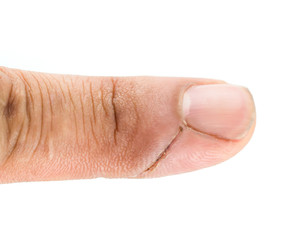 Finger cutting knife