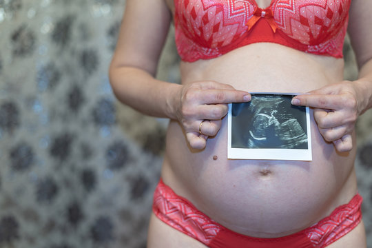 Pregnant woman in a red underwear holds a picture of an ultrasound of her baby in the belly. Health pregnancy x-ray background concept. Medical baby surveillance in womb and fetal control development.
