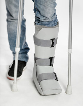 Beinbruch Fu&szlig; Bein Knochenbruch mit Orthese und Kr&uuml;cken