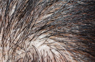 Macro photography of gray hair and black hair on Scalp.