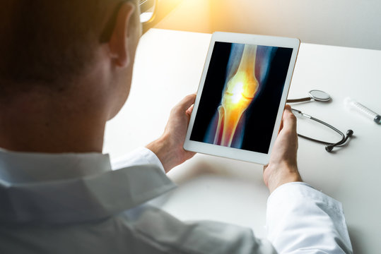 Doctor holding a digital tablet with x-ray of pain on a knee. Front view