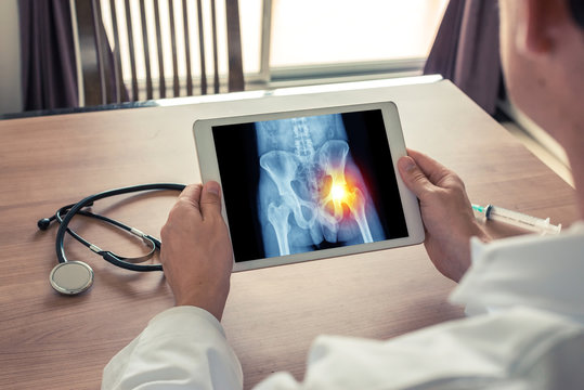 Doctor holding a digital tablet with x-ray of hips and pain on the right