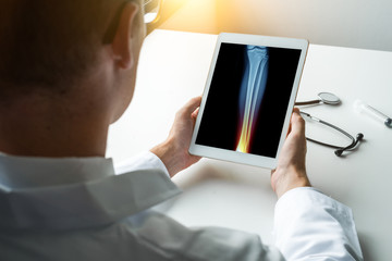 Doctor holding a digital tablet with x-ray of leg and pain on the ankle