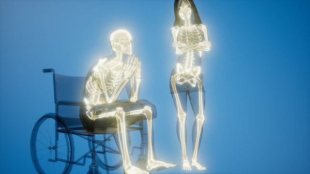man in wheelchair with visible bones