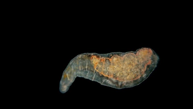 Aeolosoma worm under a microscope, a young worm Oligochaeta, feeds on plant detritus, hermaphrodites, are of great importance for the self-purification processes of polluted water bodies