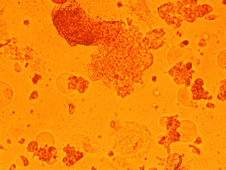 cell virus Micro organism view from microscope