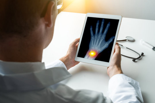Doctor holding a digital tablet with x-ray of a left hand with pain on the wrist. Osteoarthritis concept