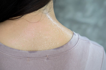 woman neck and back with allergy sweat skin closeup 