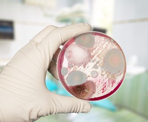 Microbiology laboratory test in scientist hand on background
