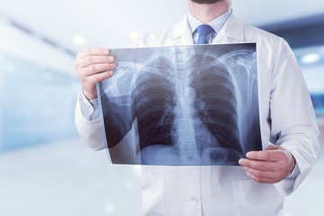 Fototapeta na wymiar Young male doctor examining x-ray on white