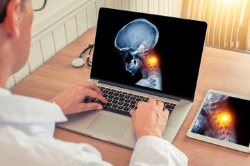 Doctor watching a laptop with x-ray of skull with pain relief in the neck in a medical office. Headache migraine or trauma concept