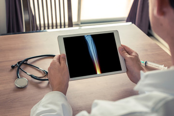 Doctor holding a digital tablet with x-ray of leg and pain on the ankle