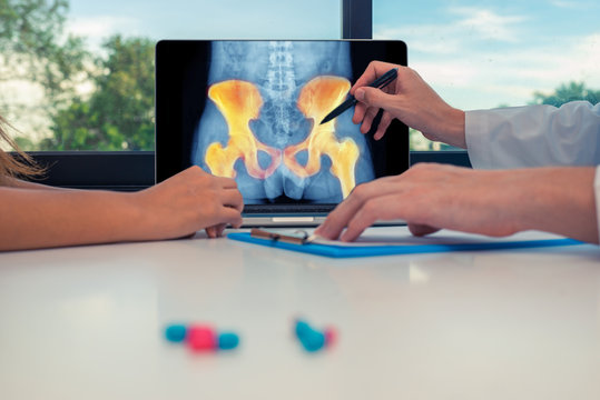 Doctor showing a x-ray of hips with pain on a laptop to a woman patient. Pills on the desk