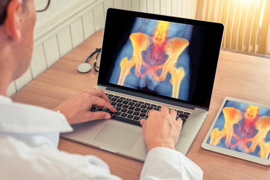 Doctor watching a laptop and digital tablet with x-ray of hips and spine with pain relief in a medical office