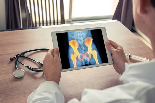 Doctor holding a digital tablet with x-ray of hips and pain