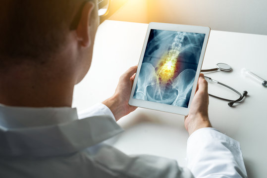 Doctor holding a digital tablet with x-ray of hips with pain on the spine