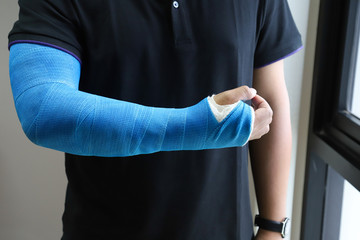 Closeup of Asian man's arm with long arm plaster, fiberglass cast therapy cover by blue elastic bandage after sport injury. 